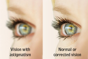 What is Astigmatism?