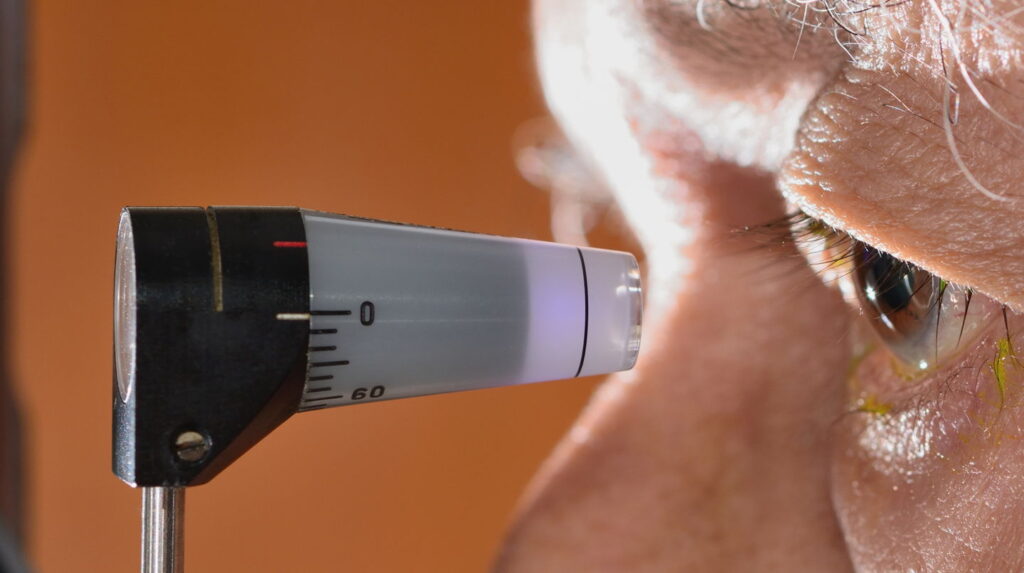 Glaucoma Surgery in Atlanta: When It’s Needed and What to Expect