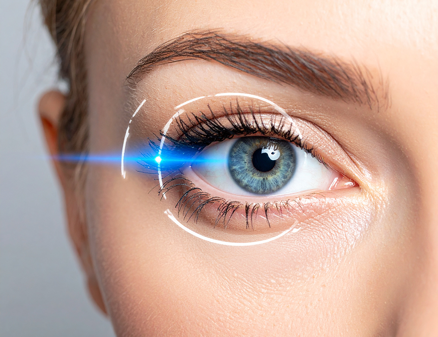 Am-I-A-Candidate-for-LASIK