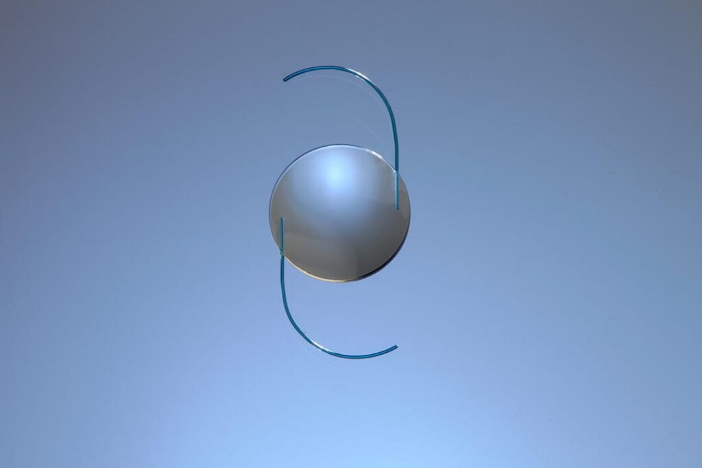 light adjustable lens for cataract surgery